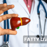 Fatty_liver_causes_treatments_dr_shweta_soni_ayurveda